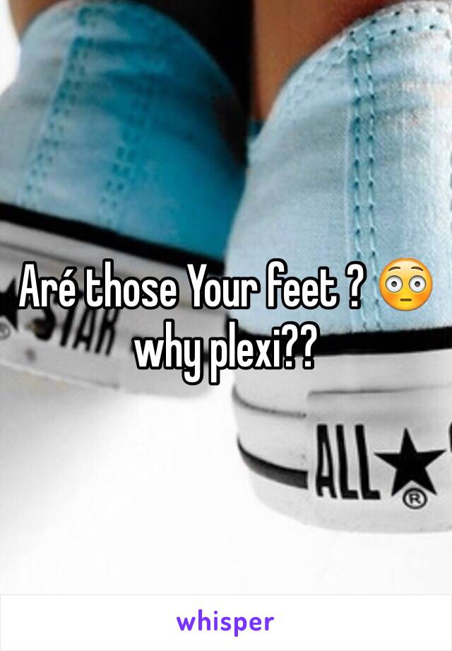 Aré those Your feet ? 😳 why plexi??