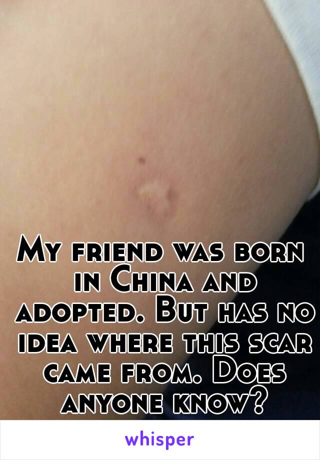 My friend was born in China and adopted. But has no idea where this scar came from. Does anyone know?