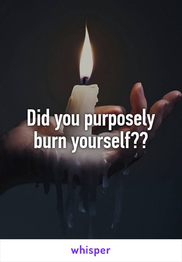 Did you purposely burn yourself??