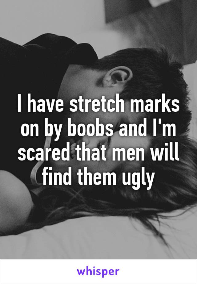 I have stretch marks on by boobs and I'm scared that men will find them ugly