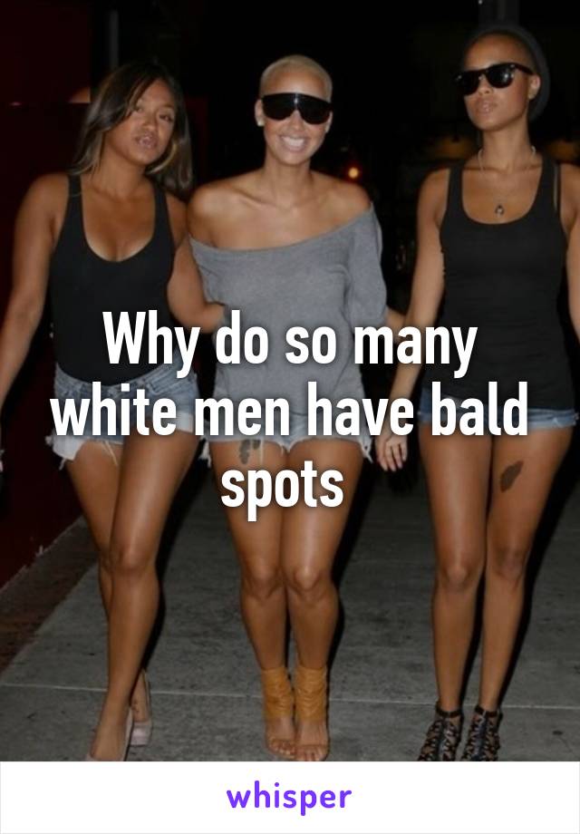 Why do so many white men have bald spots 