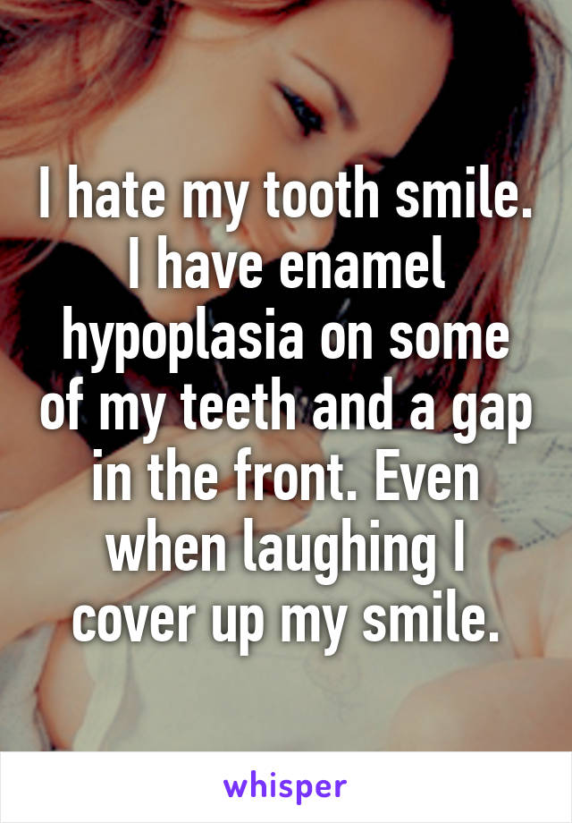 I hate my tooth smile. I have enamel hypoplasia on some of my teeth and a gap in the front. Even when laughing I cover up my smile.