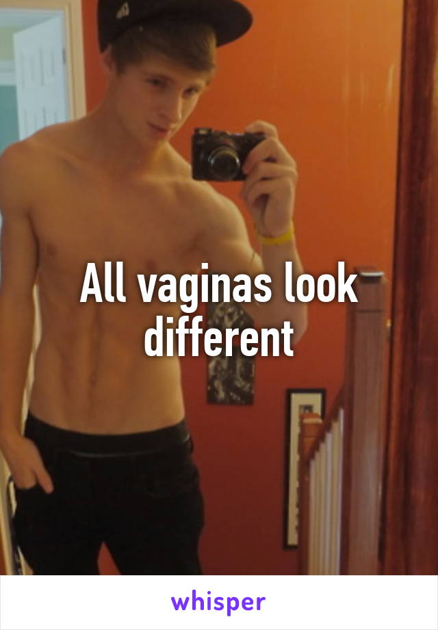 All vaginas look different
