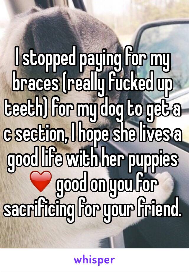 I stopped paying for my braces (really fucked up teeth) for my dog to get a c section, I hope she lives a good life with her puppies ❤️ good on you for sacrificing for your friend.