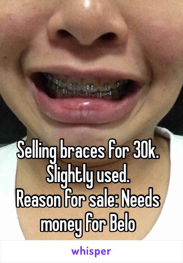 Selling braces for 30k. Slightly used. 
Reason for sale: Needs money for Belo