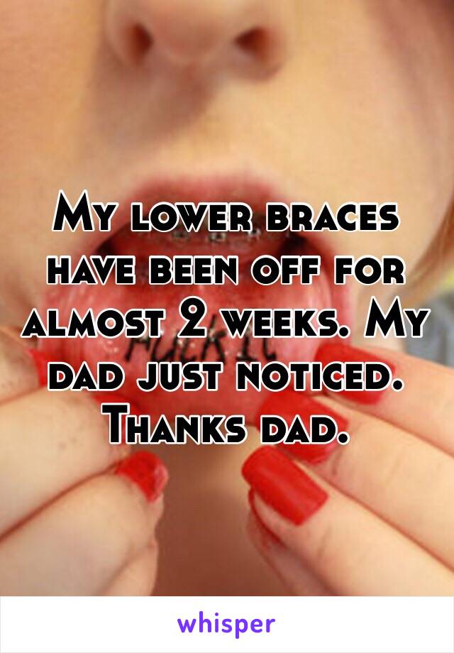 My lower braces have been off for almost 2 weeks. My dad just noticed.
Thanks dad.