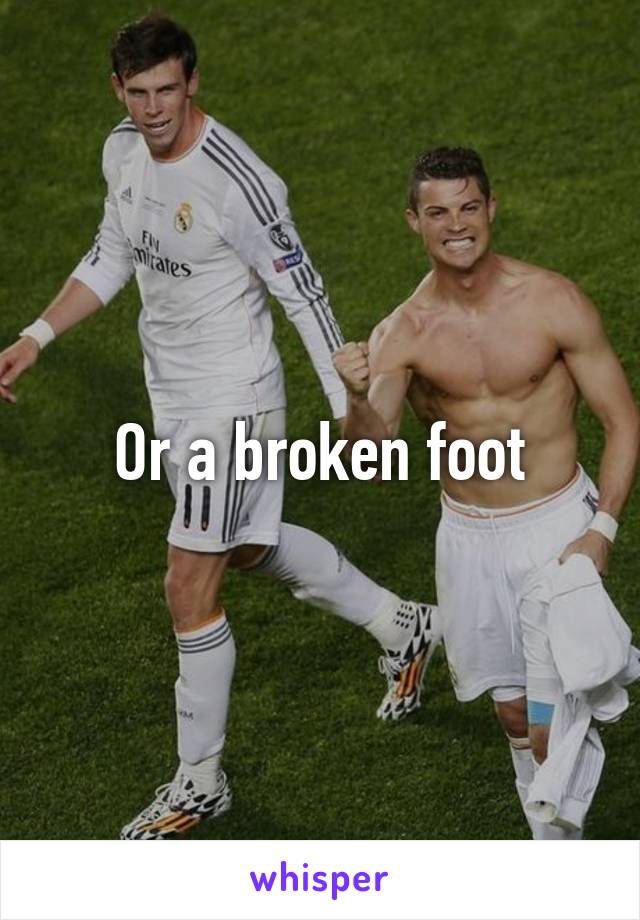 Or a broken foot