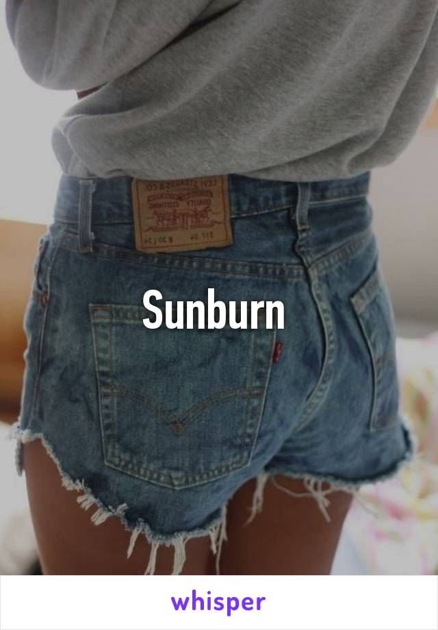 Sunburn 