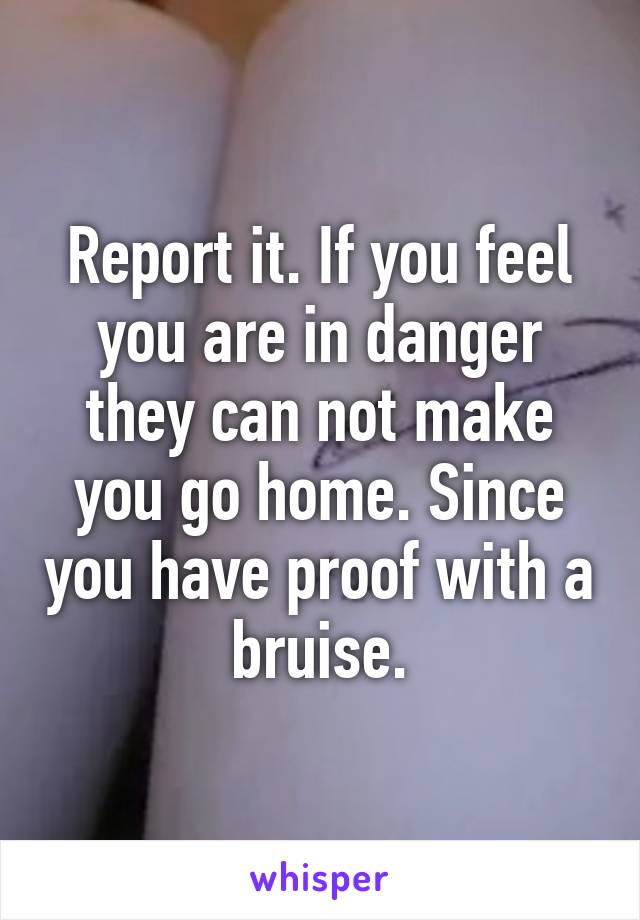 Report it. If you feel you are in danger they can not make you go home. Since you have proof with a bruise.