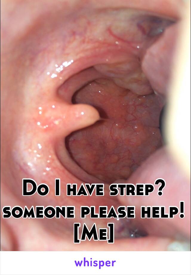 Do I have strep? 
someone please help!
[Me]