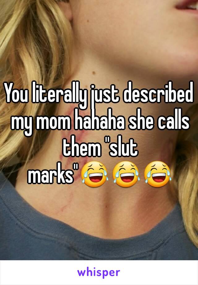 You literally just described my mom hahaha she calls them "slut marks"😂😂😂