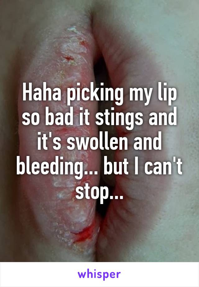 Haha picking my lip so bad it stings and it's swollen and bleeding... but I can't stop...