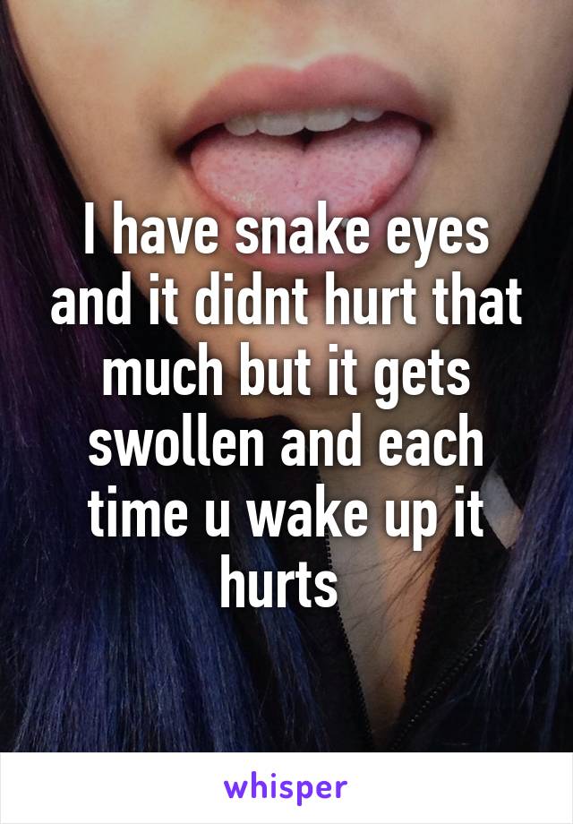 I have snake eyes and it didnt hurt that much but it gets swollen and each time u wake up it hurts 