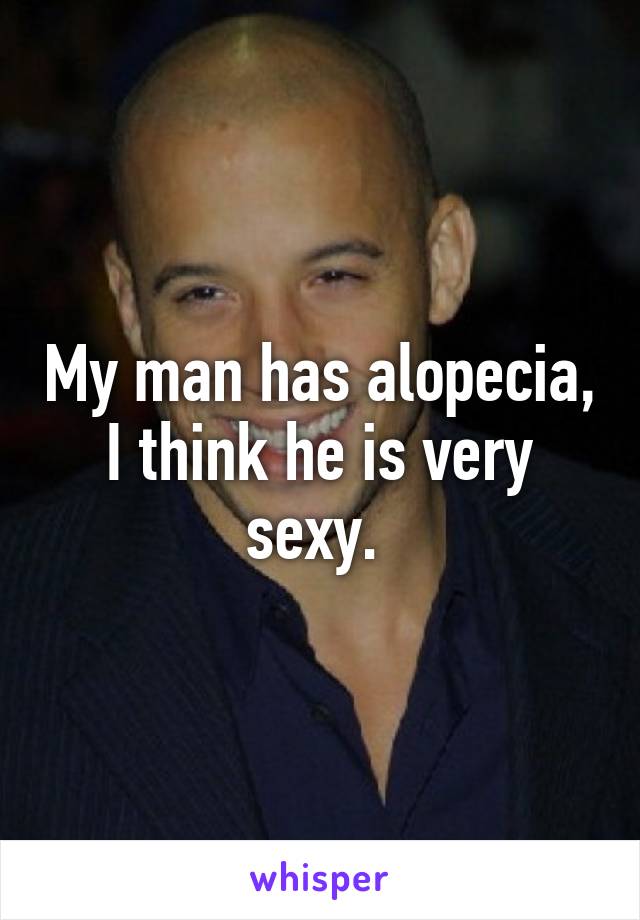 My man has alopecia, I think he is very sexy. 