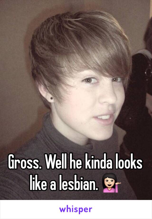 Gross. Well he kinda looks like a lesbian. 💁🏻