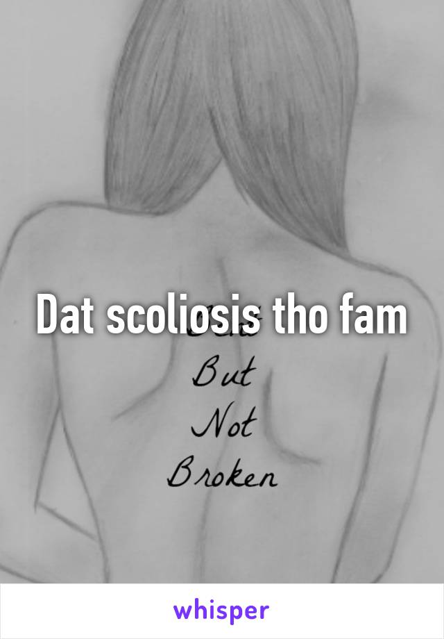 Dat scoliosis tho fam