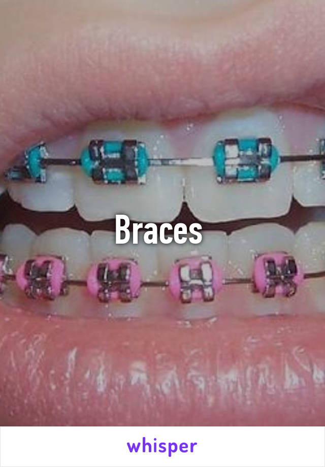 Braces 