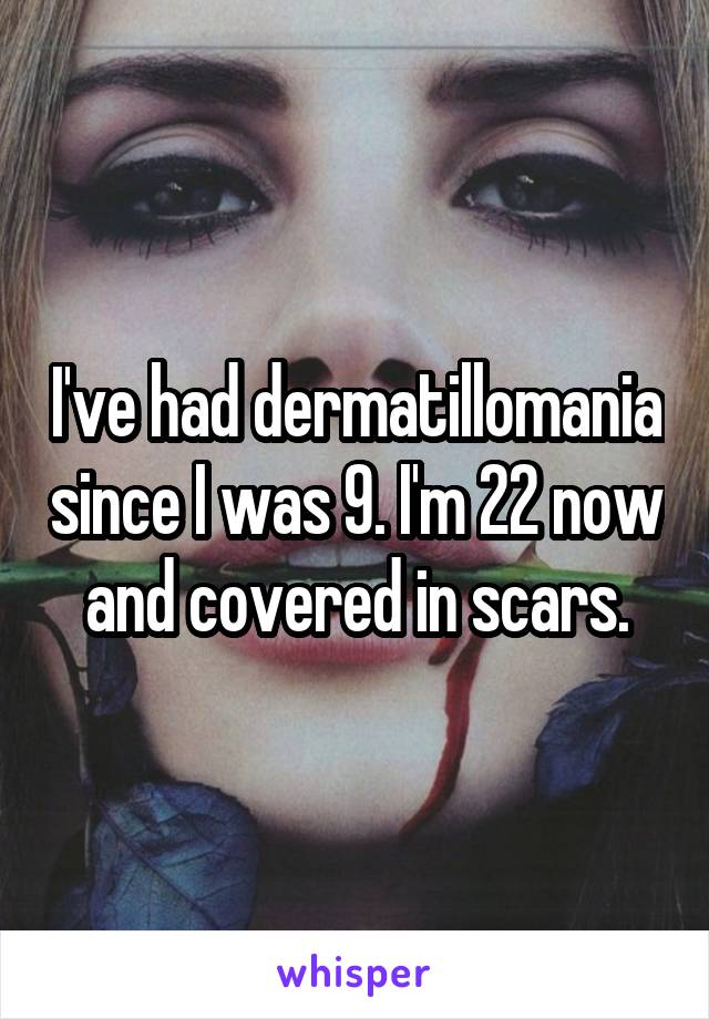 I've had dermatillomania since I was 9. I'm 22 now and covered in scars.