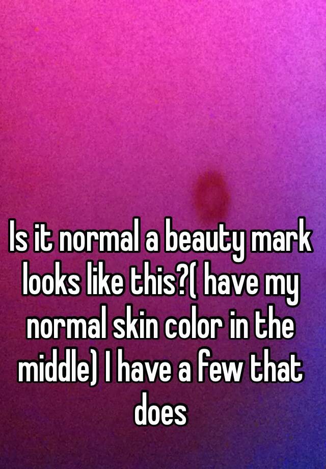 is-it-normal-a-beauty-mark-looks-like-this-have-my-normal-skin-color