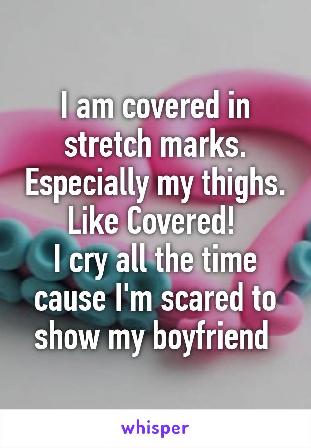 I am covered in stretch marks. Especially my thighs. Like Covered! 
I cry all the time cause I'm scared to show my boyfriend 