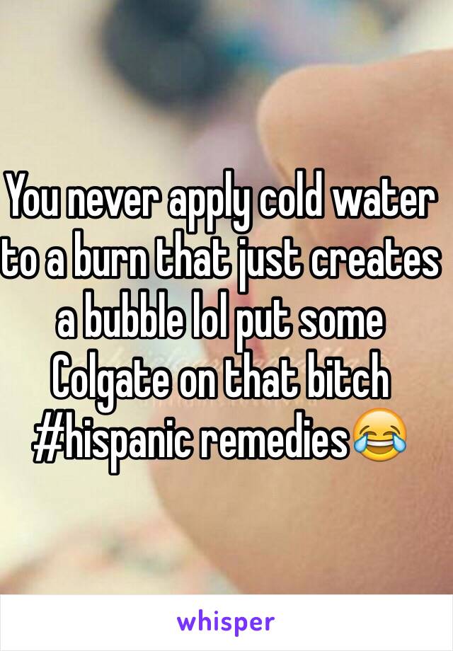 You never apply cold water to a burn that just creates a bubble lol put some Colgate on that bitch #hispanic remedies😂