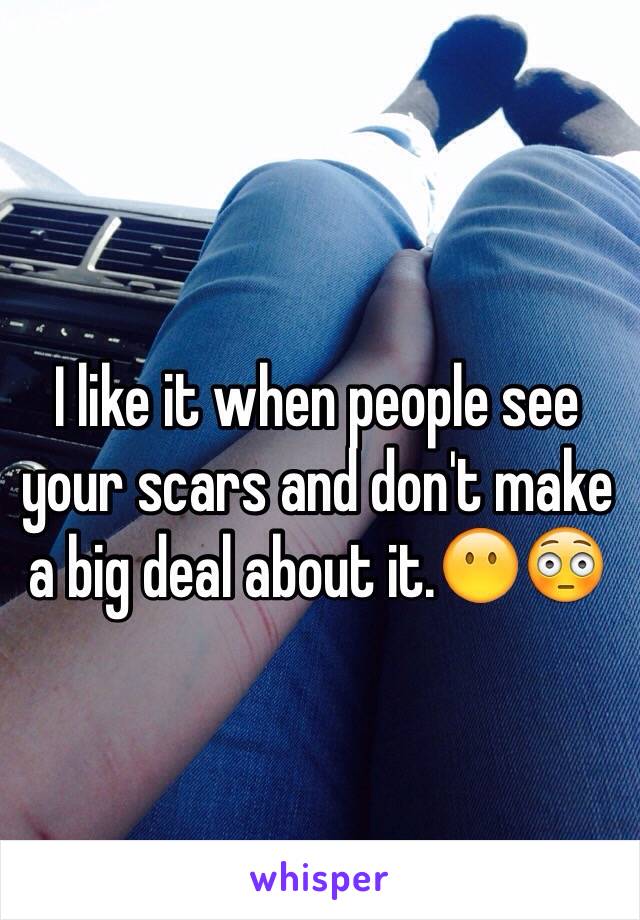 I like it when people see your scars and don't make a big deal about it.😶😳