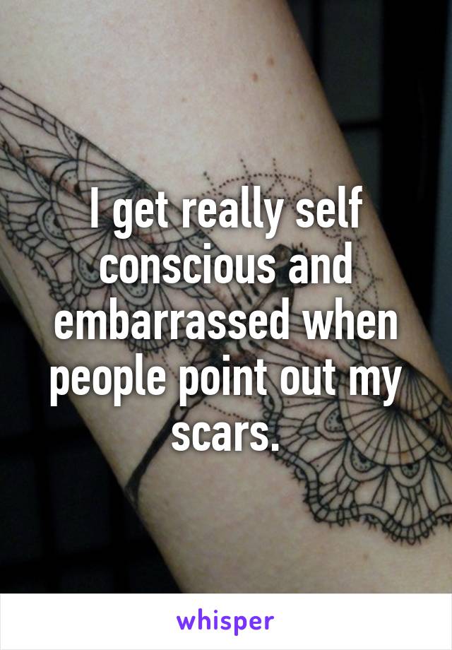 I get really self conscious and embarrassed when people point out my scars.