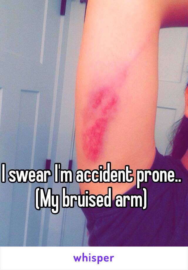 I swear I'm accident prone.. 
(My bruised arm)