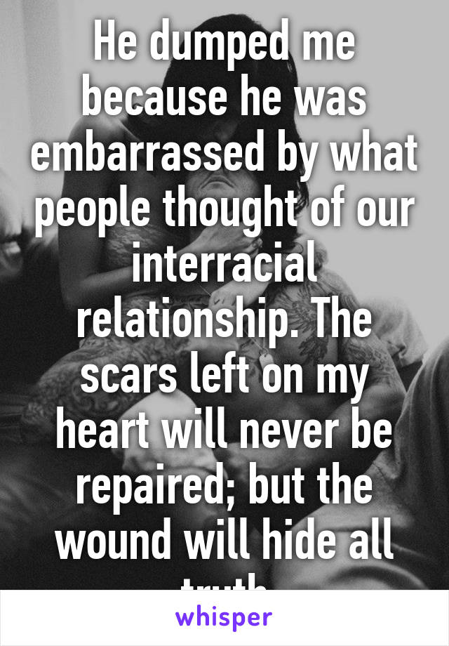 He dumped me because he was embarrassed by what people thought of our interracial relationship. The scars left on my heart will never be repaired; but the wound will hide all truth