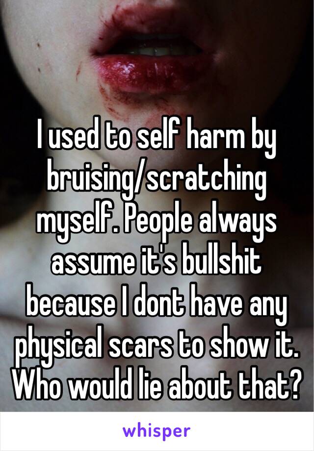 I used to self harm by bruising/scratching myself. People always assume it's bullshit because I dont have any physical scars to show it. 
Who would lie about that?