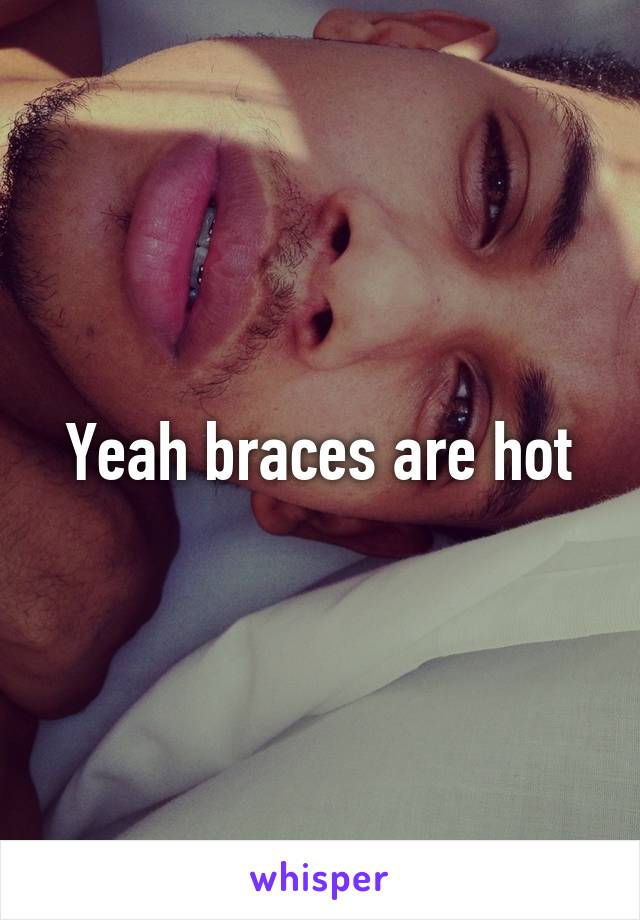 Yeah braces are hot