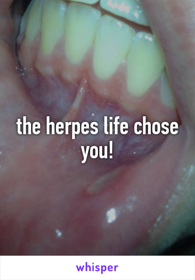 the herpes life chose you!