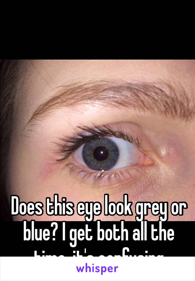Does this eye look grey or blue? I get both all the time, it's confusing 