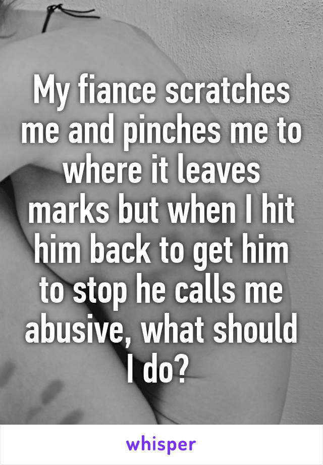 My fiance scratches me and pinches me to where it leaves marks but when I hit him back to get him to stop he calls me abusive, what should I do? 