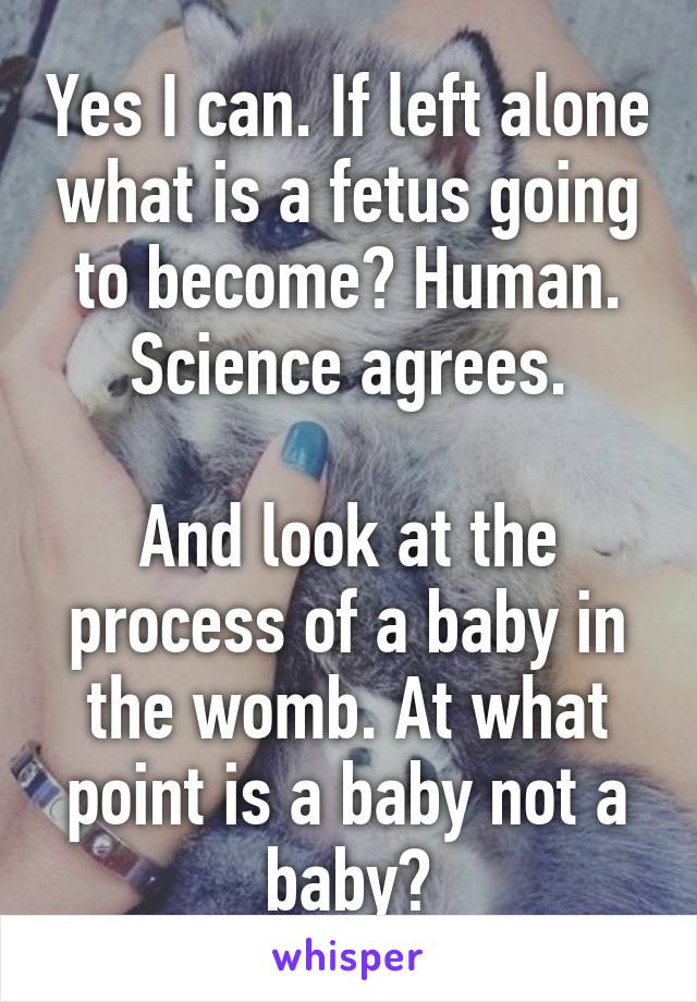 Yes I can. If left alone what is a fetus going to become? Human. Science agrees.

And look at the process of a baby in the womb. At what point is a baby not a baby?