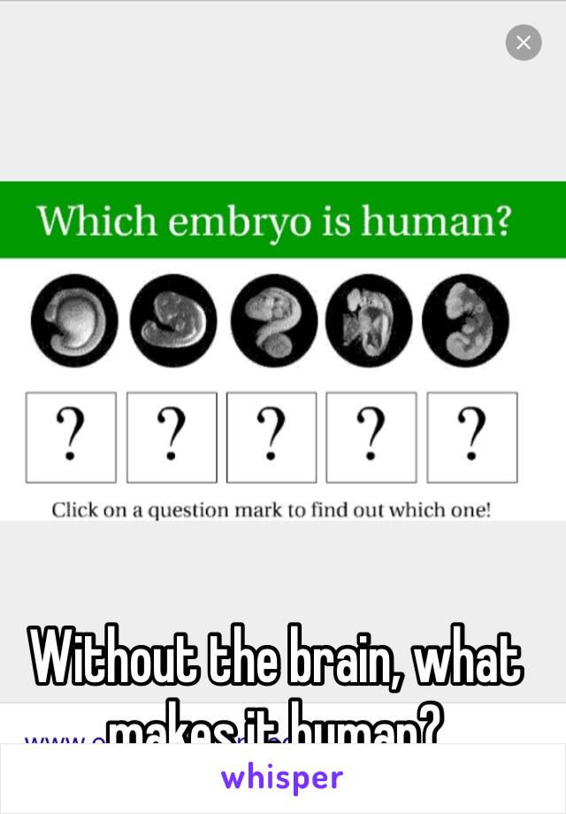 Without the brain, what makes it human?