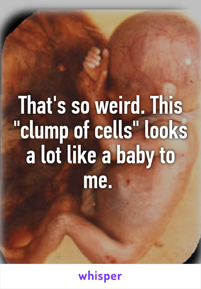 That's so weird. This "clump of cells" looks a lot like a baby to me. 