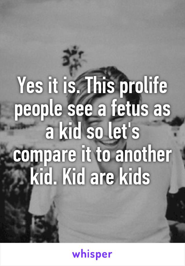 Yes it is. This prolife people see a fetus as a kid so let's compare it to another kid. Kid are kids 