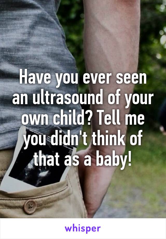 Have you ever seen an ultrasound of your own child? Tell me you didn't think of that as a baby!