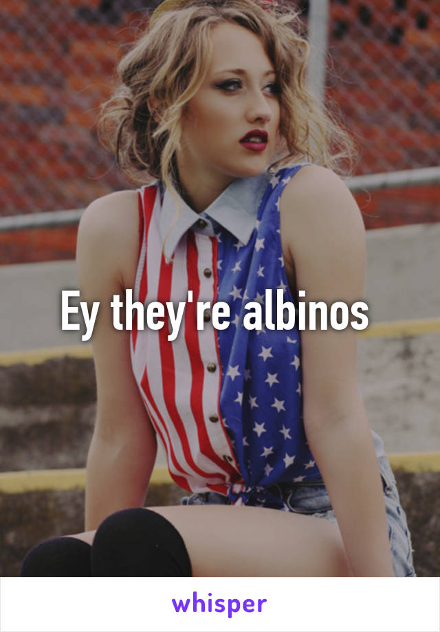 Ey they're albinos 