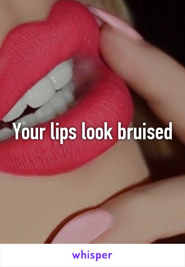 Your lips look bruised