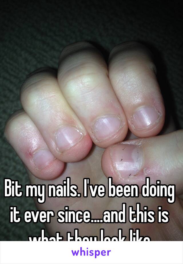 Bit my nails. I've been doing it ever since....and this is what they look like