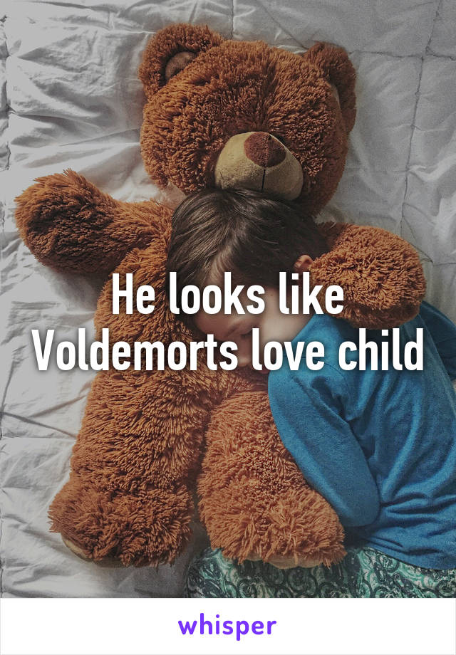 He looks like Voldemorts love child