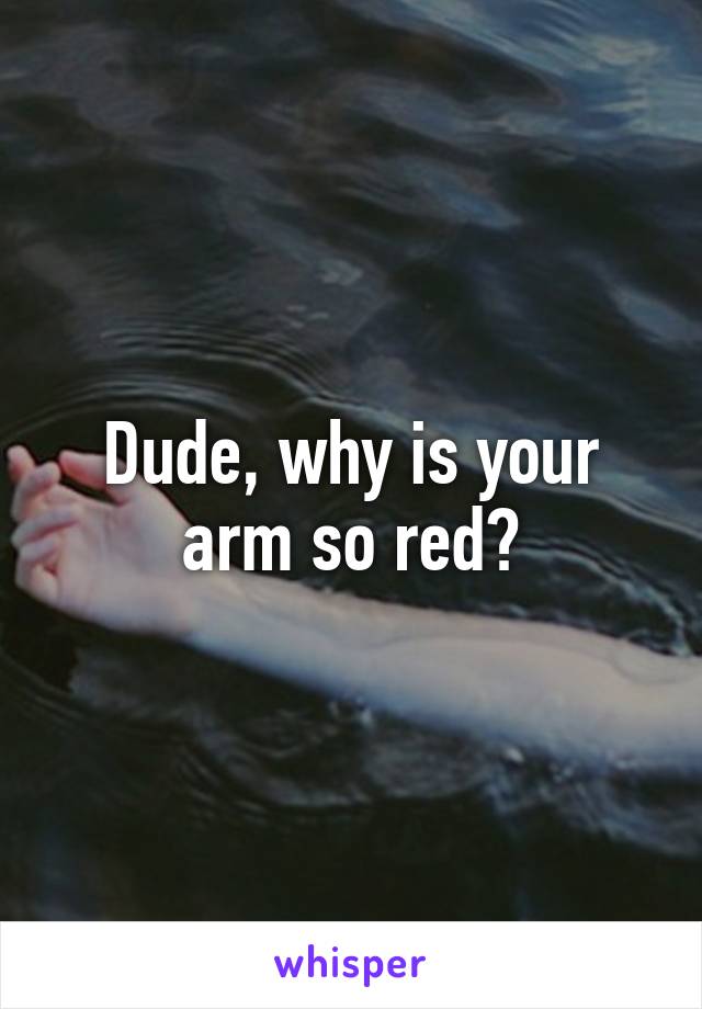 Dude, why is your arm so red?