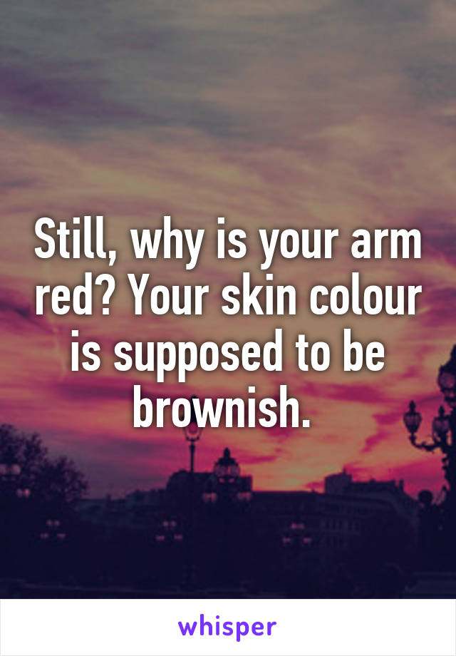 Still, why is your arm red? Your skin colour is supposed to be brownish. 