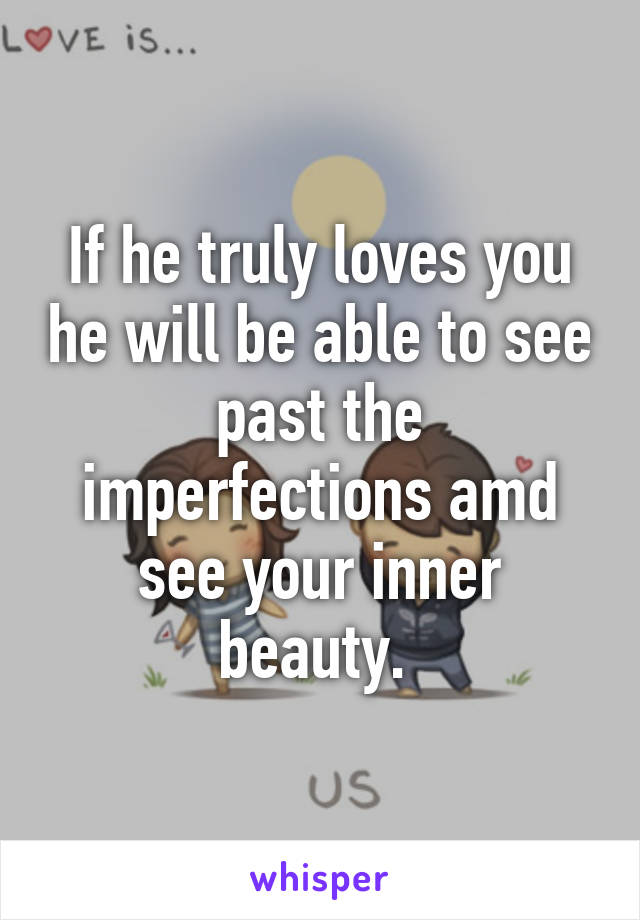 If he truly loves you he will be able to see past the imperfections amd see your inner beauty. 