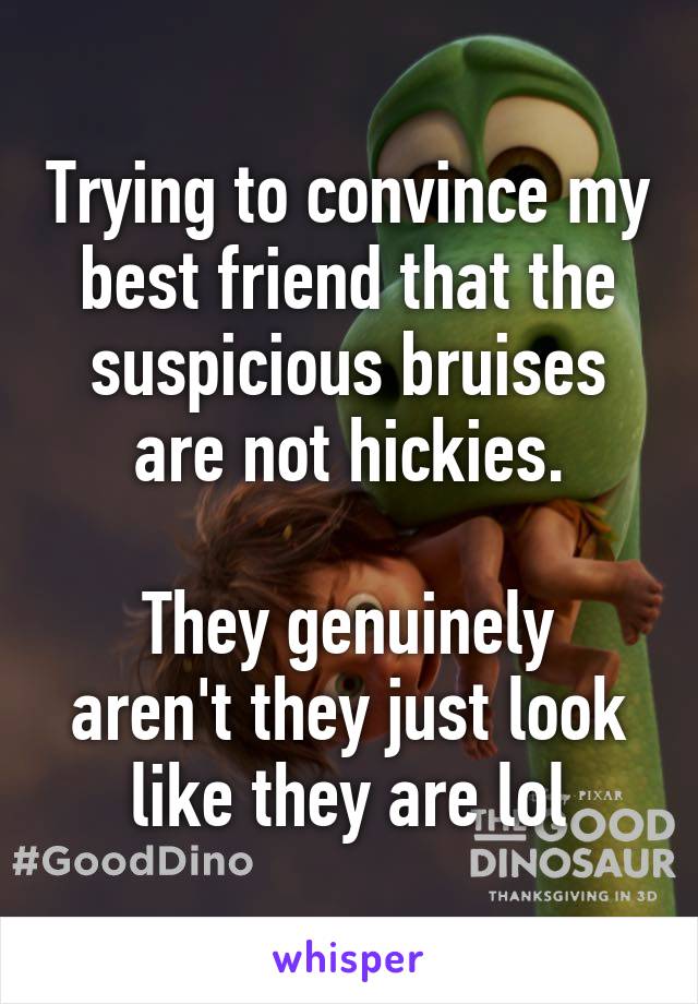Trying to convince my best friend that the suspicious bruises are not hickies.

They genuinely aren't they just look like they are lol