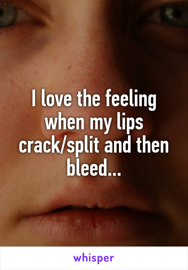 I love the feeling when my lips crack/split and then bleed...