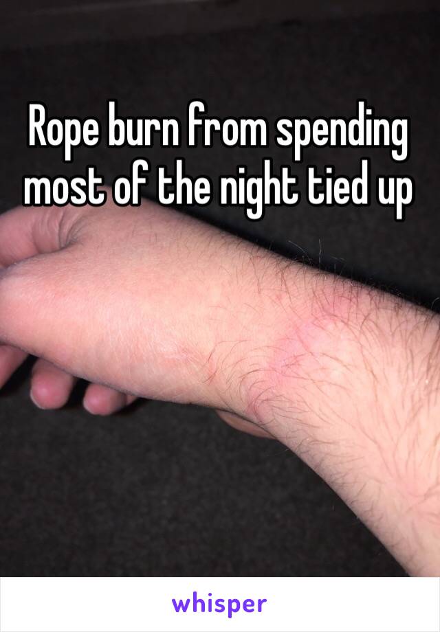 Rope burn from spending most of the night tied up 