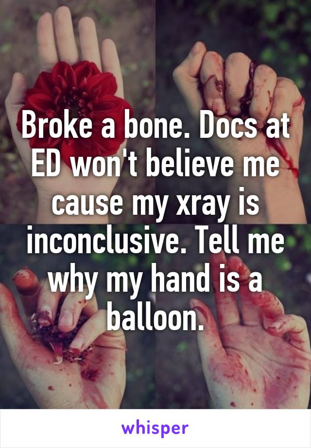 Broke a bone. Docs at ED won't believe me cause my xray is inconclusive. Tell me why my hand is a balloon.